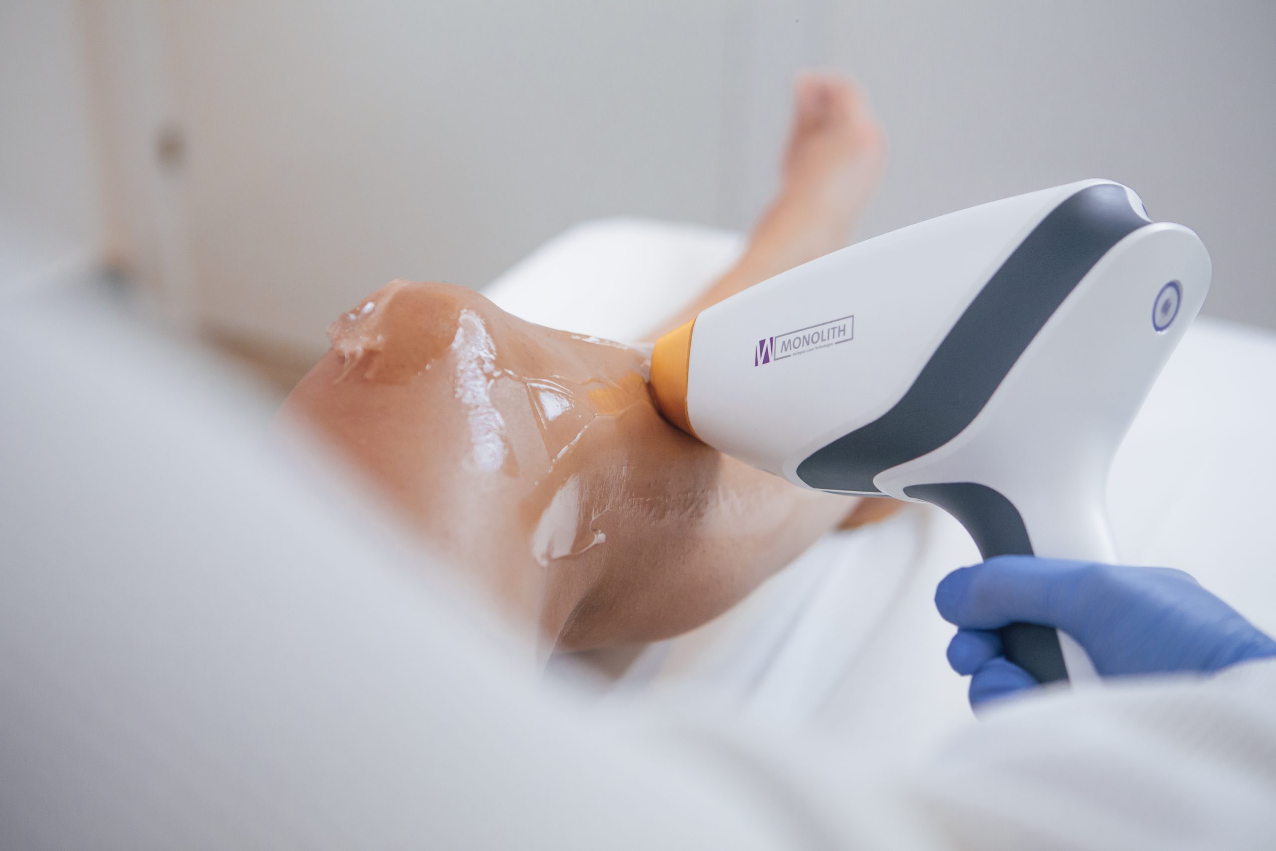 Een behandeling met het MeDioStar-laserhandstuk