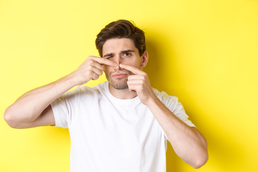 Acne uitbraak na de zomer