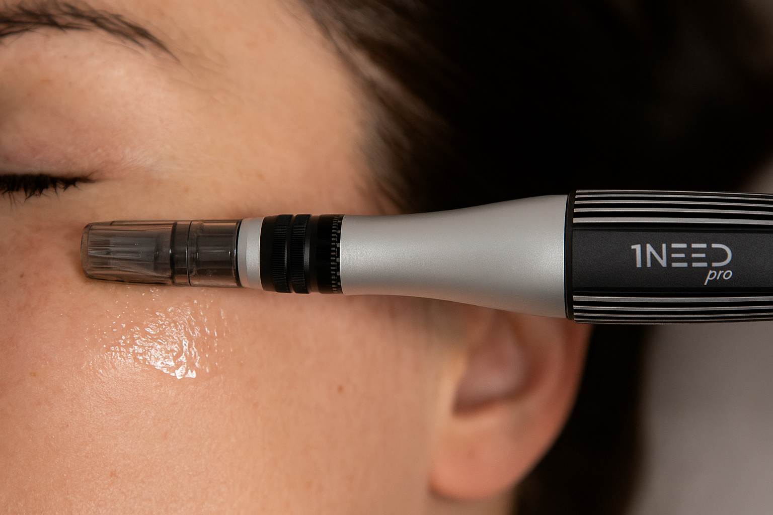 Microneedling van de gezichtshuid met de 1NEED Pro